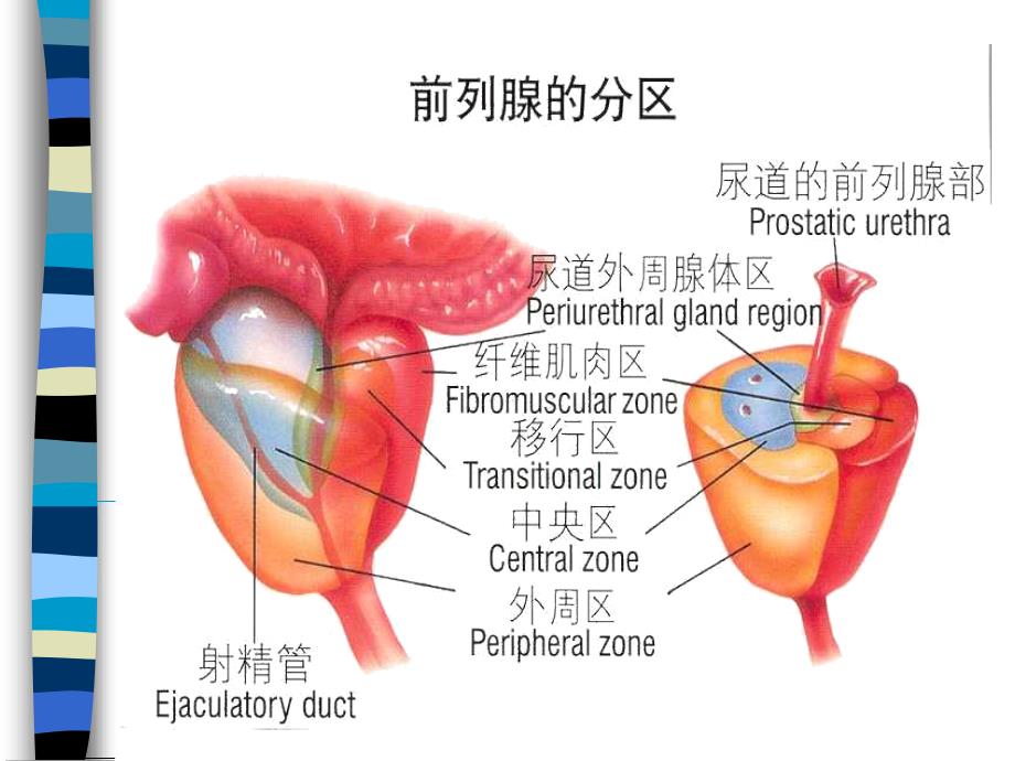 慢性前列腺炎-和男性不育_第2页