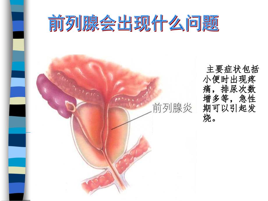 慢性前列腺炎-和男性不育_第4页