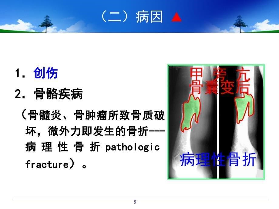 骨折概述PPT课件.ppt_第5页