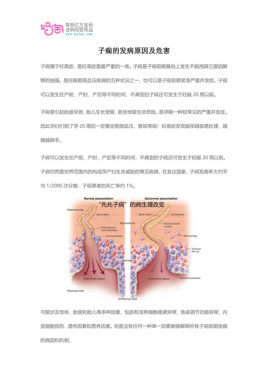 子痫的发病原因及危害.doc_第1页