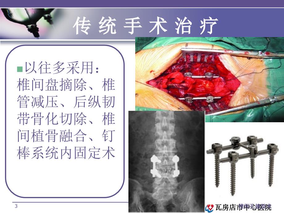 椎间孔镜技术课件_第3页