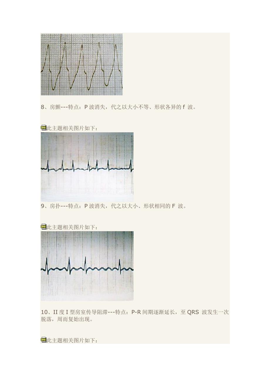 快速学习心电图(精品)_第4页