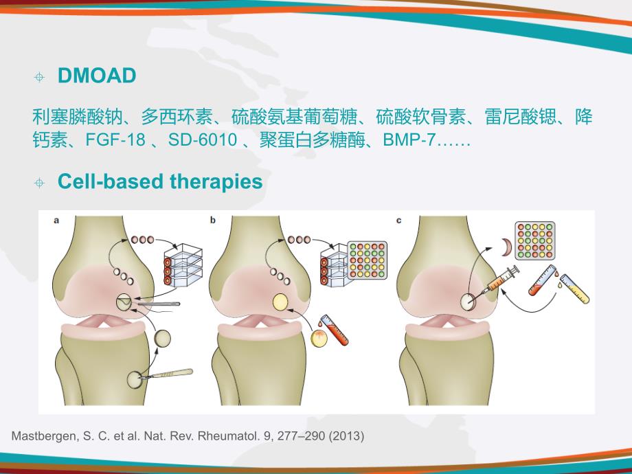 牵张术在踝关节软骨修复中的运用ppt课件_第3页