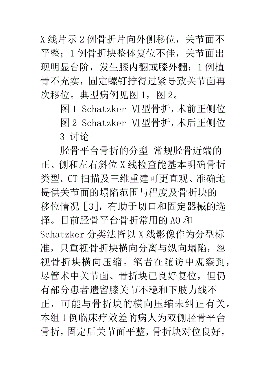 治疗胫骨平台骨折3种手术方法的疗效观察.docx_第4页