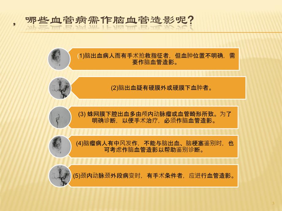 全脑血管造影术的护理ppt课件.ppt_第3页