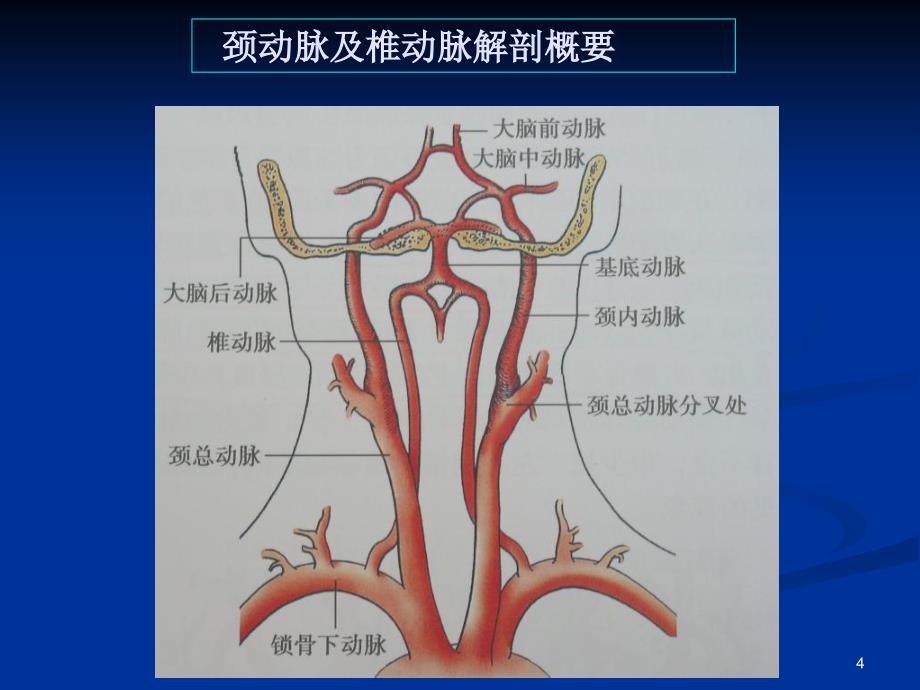 颈动脉疾病的超声诊断ppt课件_第4页