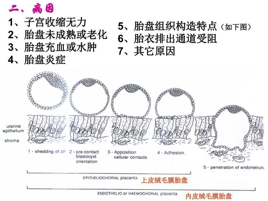 广西大学兽医产科学课件第十章产后期疾病_第5页