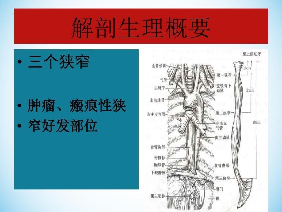 食管癌病人化疗护理ppt课件_第5页