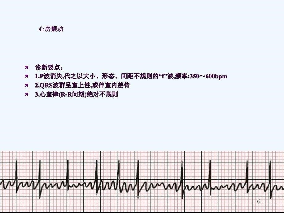 急救培训心电图ppt课件_第5页