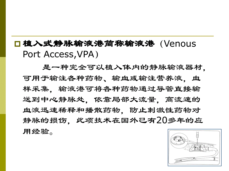 植入式静脉输液港_第3页