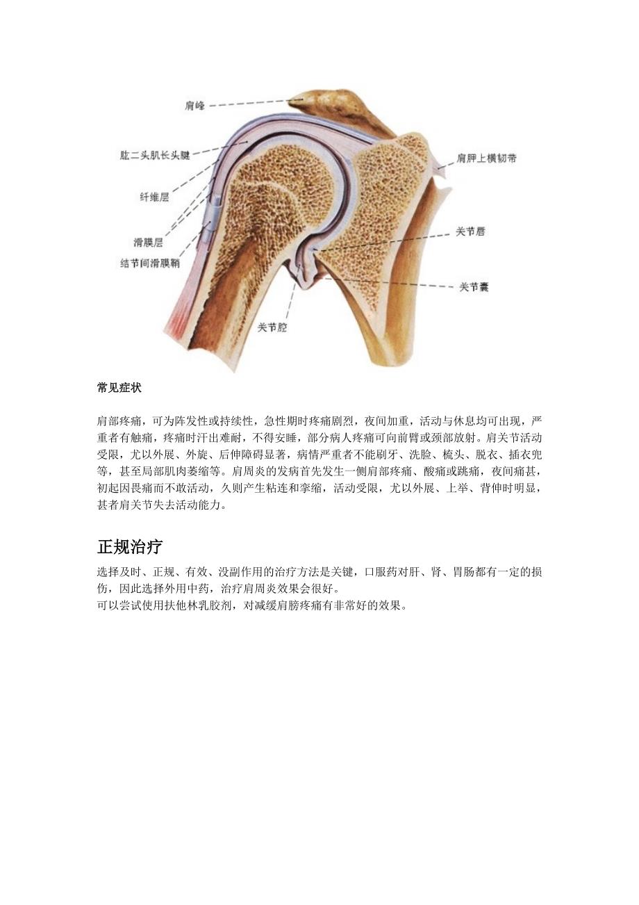 肩膀疼分类之：肩周炎引起的肩膀疼痛.doc_第3页