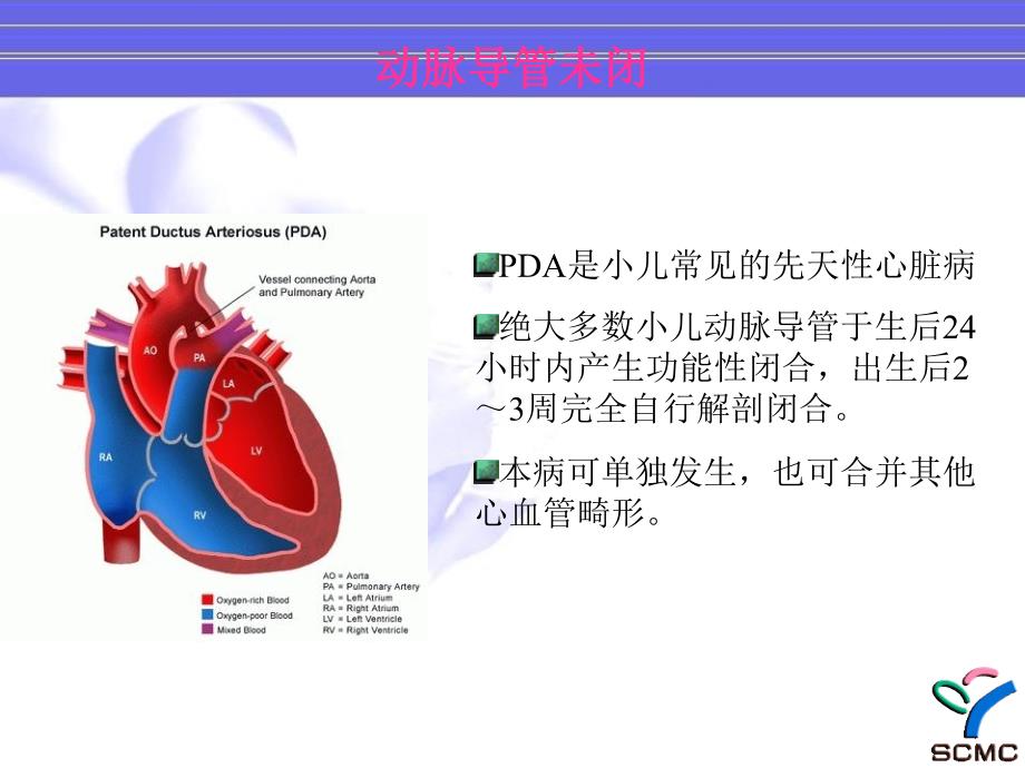 先心病手术时机和手术方法_第5页