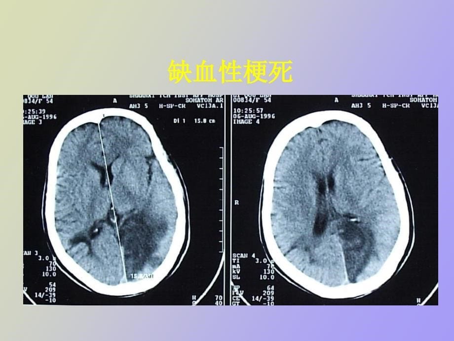 研究生医学影像学颅脑_第5页