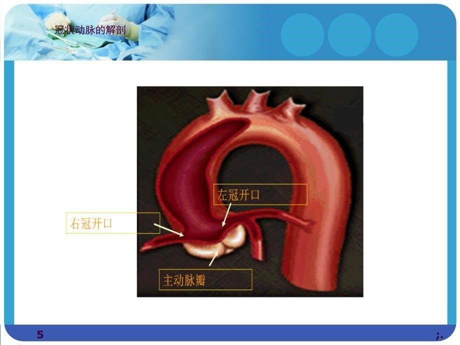 冠状动脉造影术及其护理ppt课件_第5页