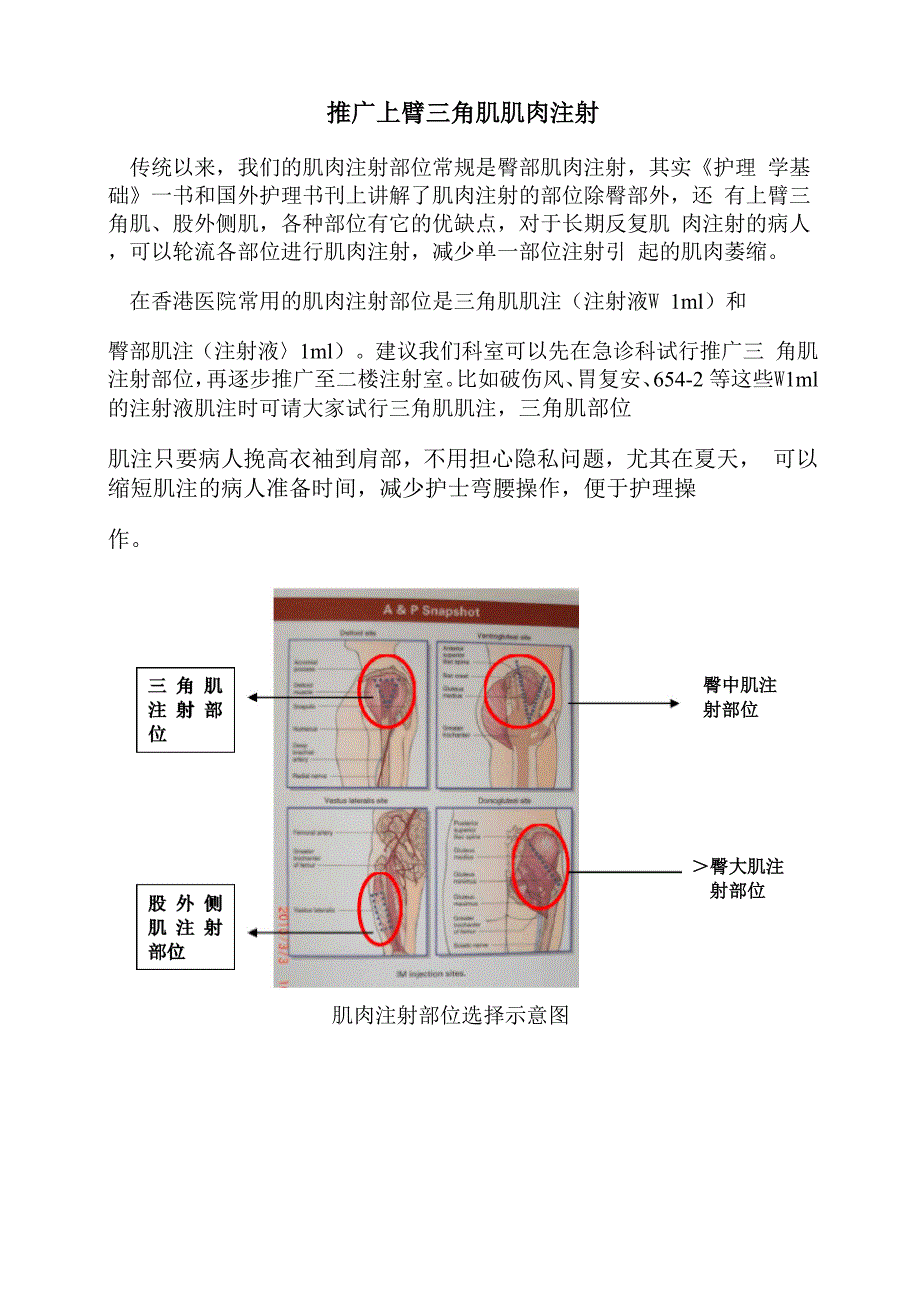 推广上臂三角肌肌肉注射_第1页