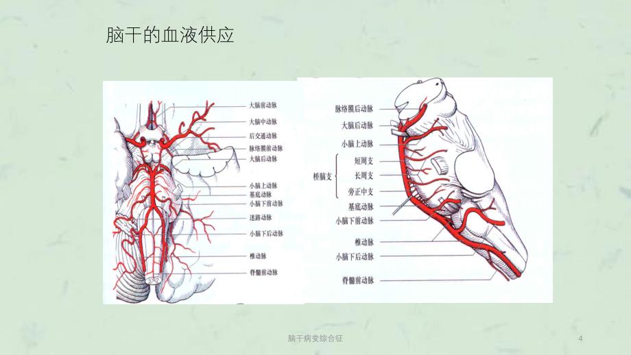 脑干病变综合征课件_第4页