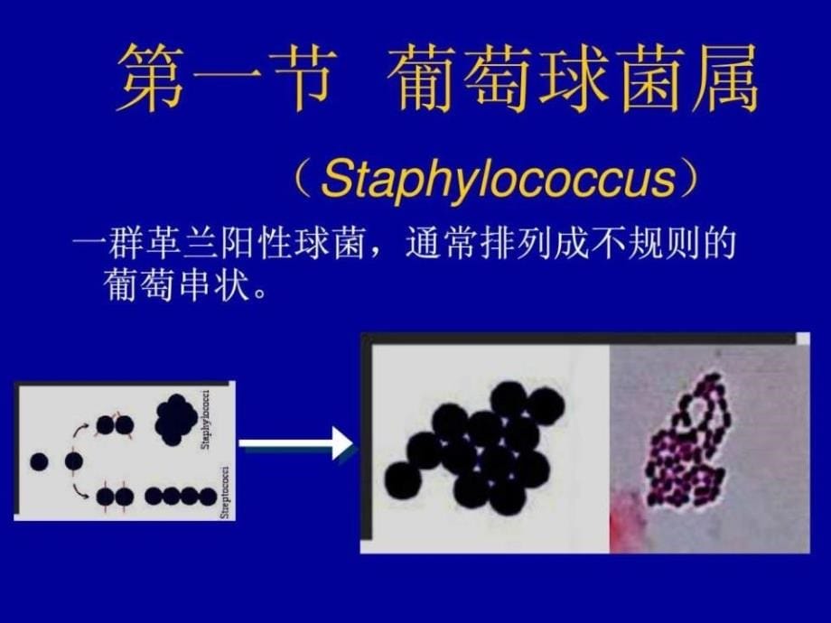 《创伤感染的细菌》PPT课件.ppt_第5页