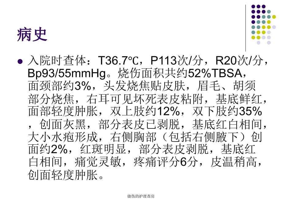 烧伤的护理查房课件_第5页