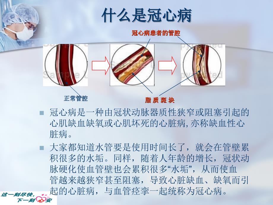 社区健康讲座PPT冠心病心绞痛的防治_第2页