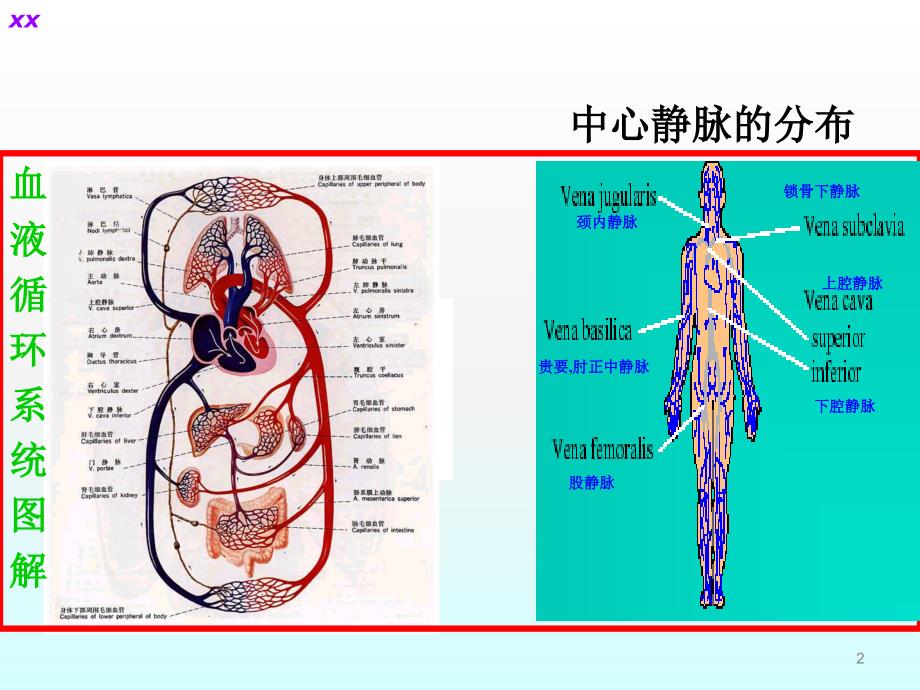 中心静脉导管护理ppt课件_第2页