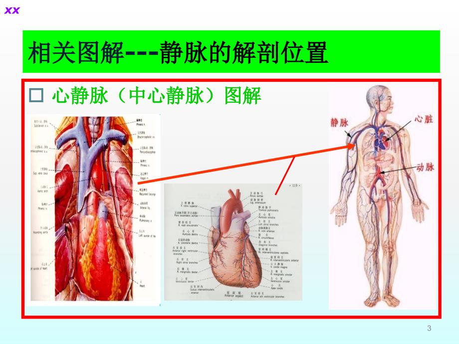 中心静脉导管护理ppt课件_第3页