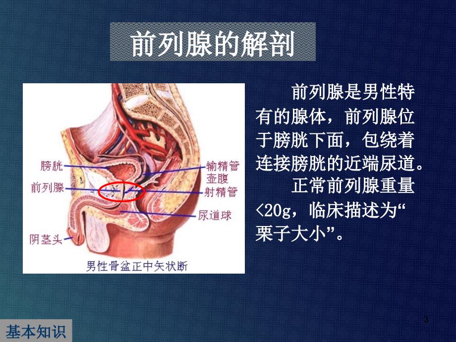 解读中国良性前列腺增生症防治指南ppt课件_第3页