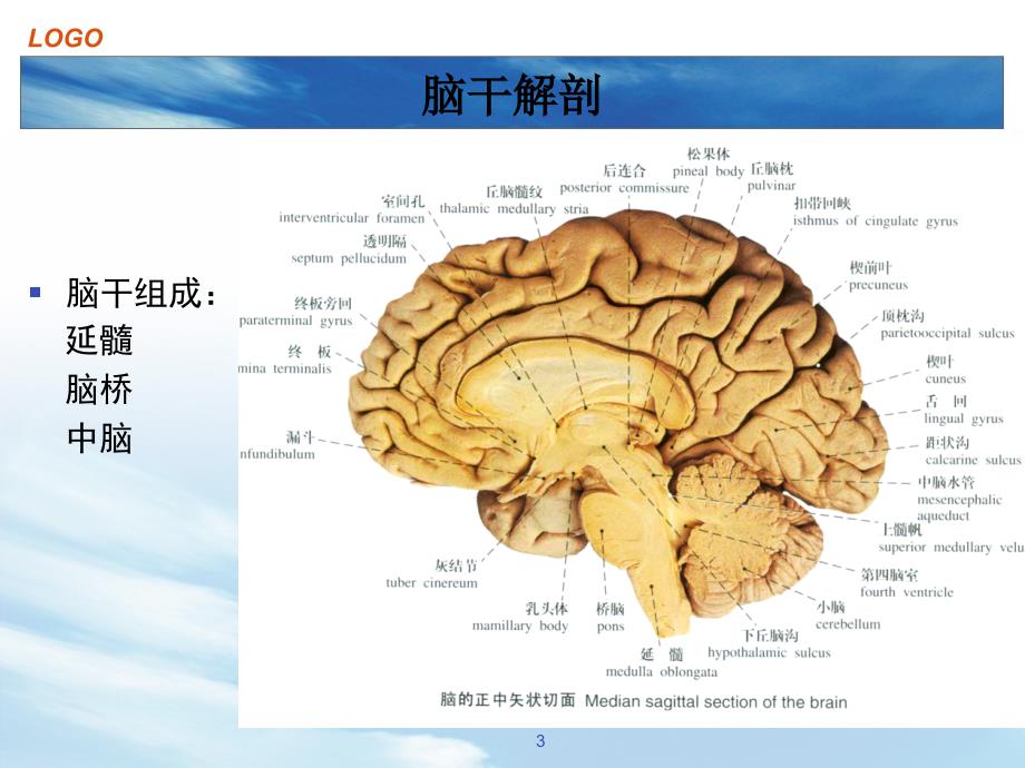 脑干出血课件_第3页