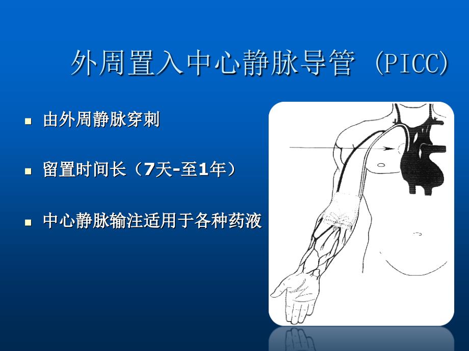 PICC技术的新进展_第3页