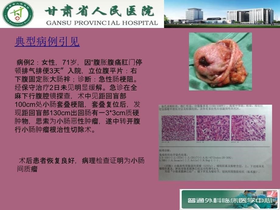 腹腔镜技术在急腹症中的应用探讨ppt课件_第5页