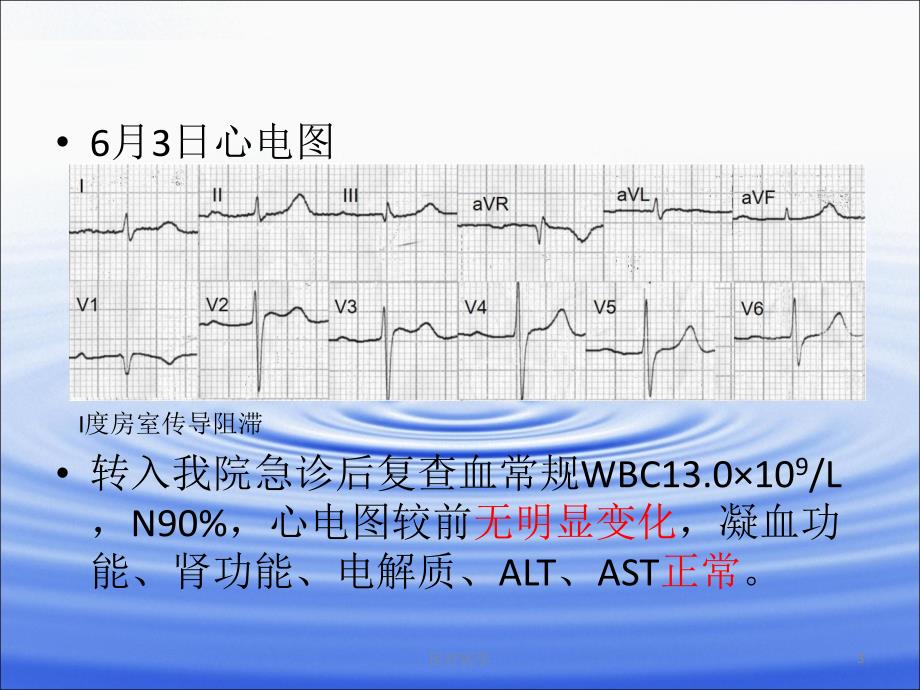 Brugada综合征业内特制_第3页