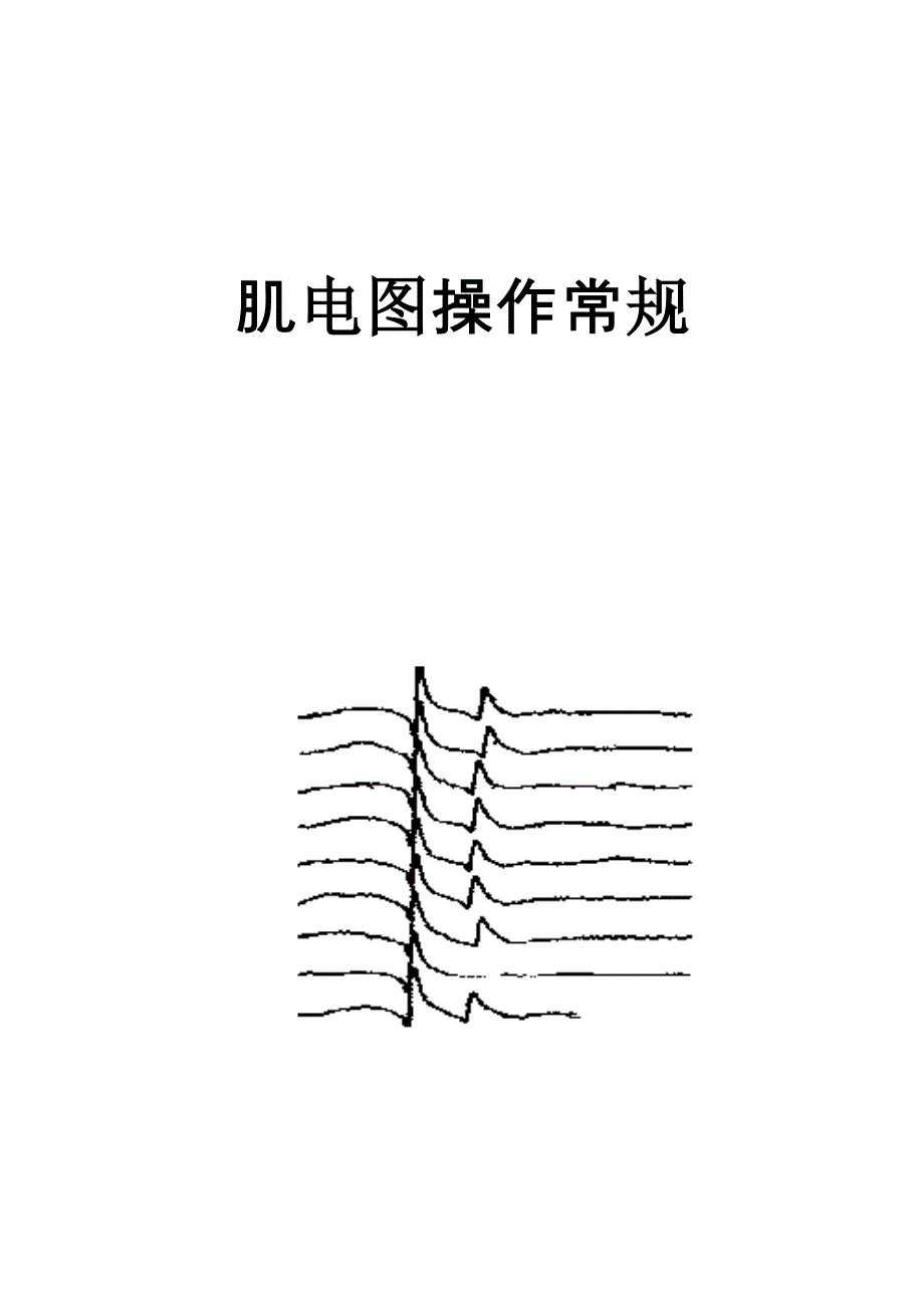 肌电图操作常规_第1页