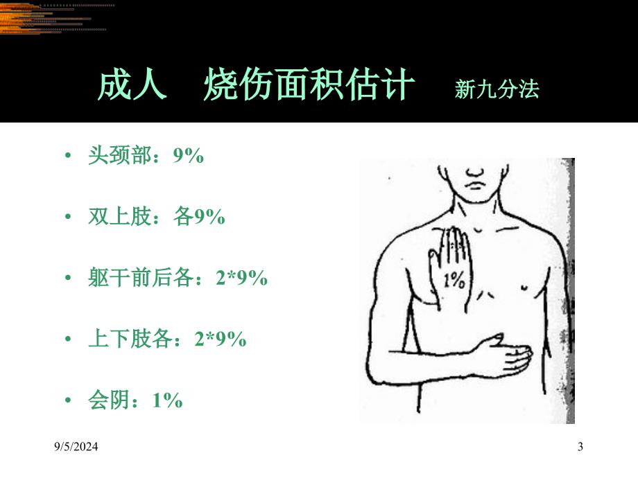 烧烫伤现场救护_第3页