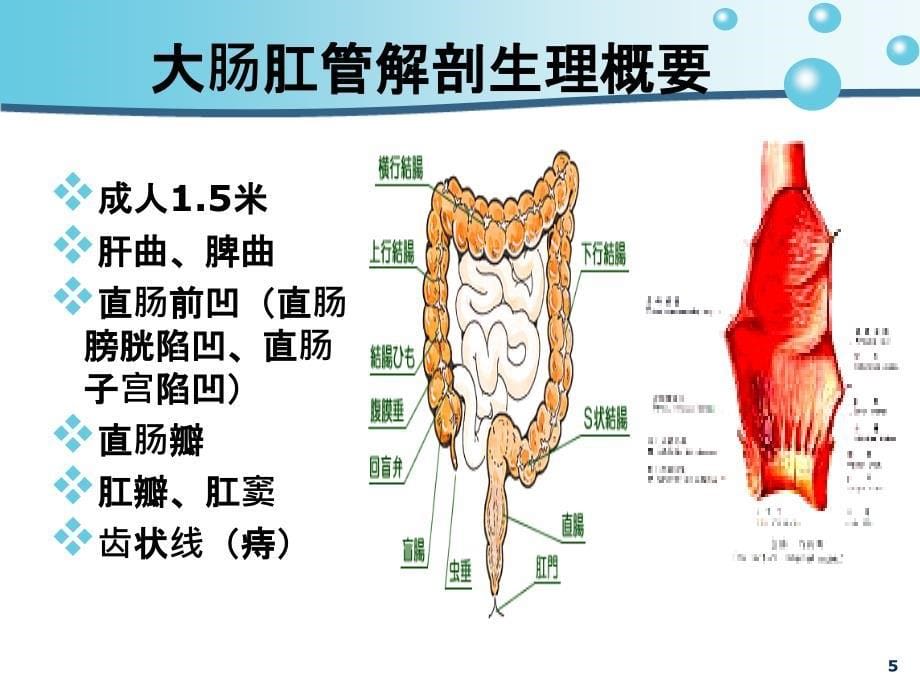 大肠肛管疾病患者的护理课件_第5页