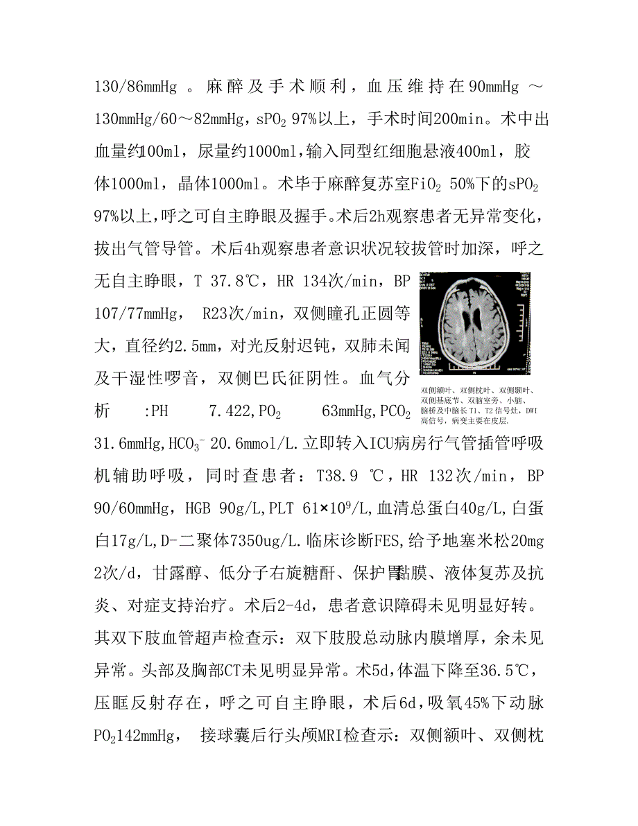 医学论文：双膝关节置换术后并发脑脂肪栓塞1例_第2页