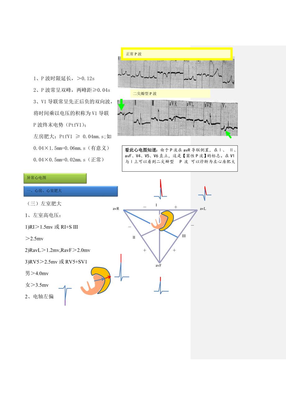 异常ECG--左右心房室肥大.doc_第2页