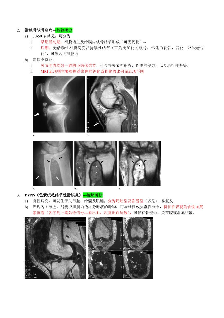 关节腔内肿物的诊断及鉴别诊断.doc_第2页