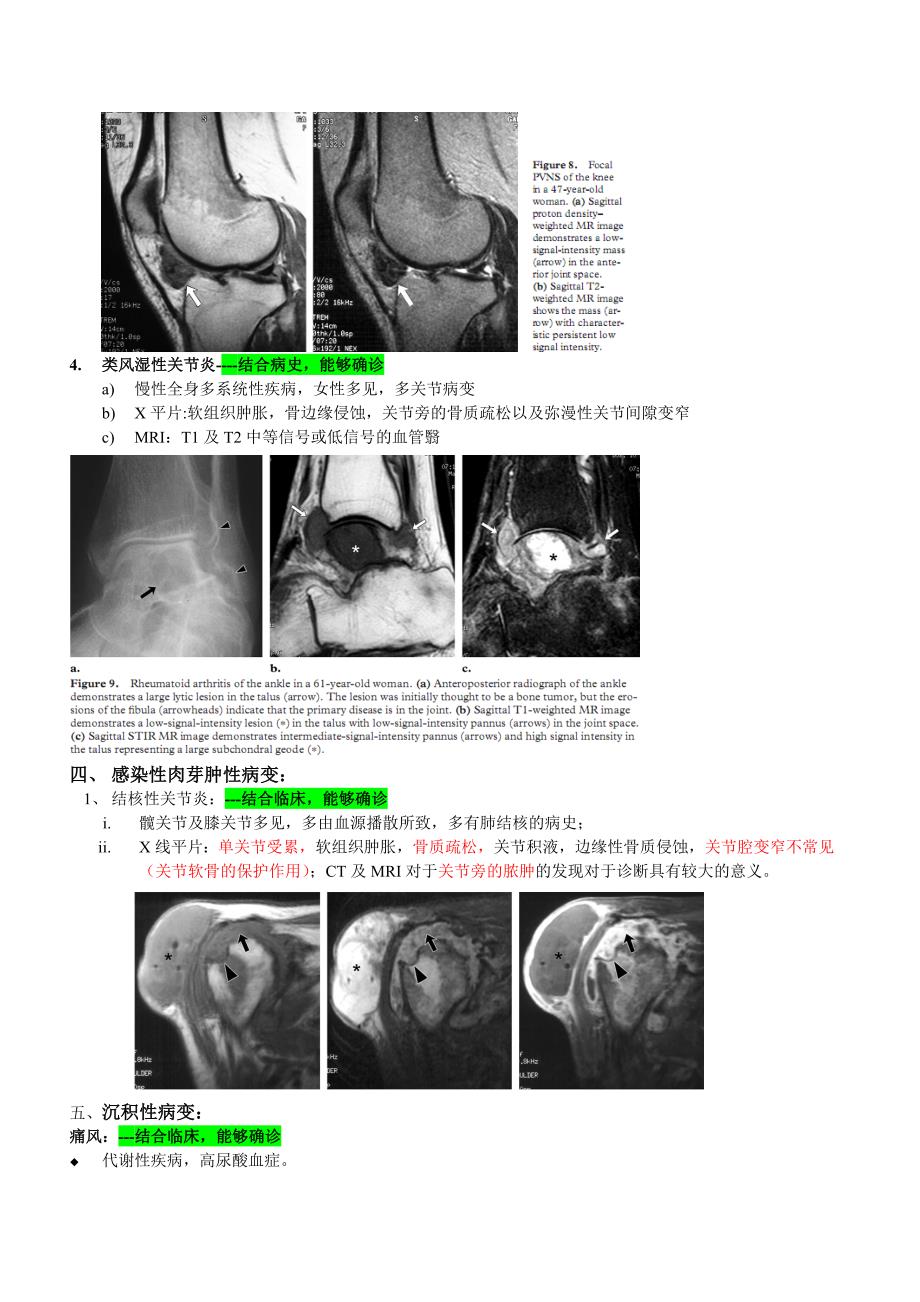 关节腔内肿物的诊断及鉴别诊断.doc_第3页