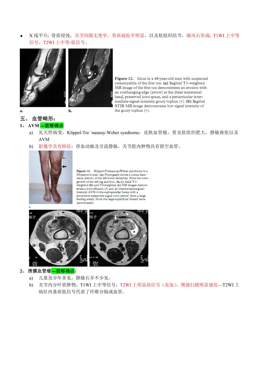 关节腔内肿物的诊断及鉴别诊断.doc_第4页