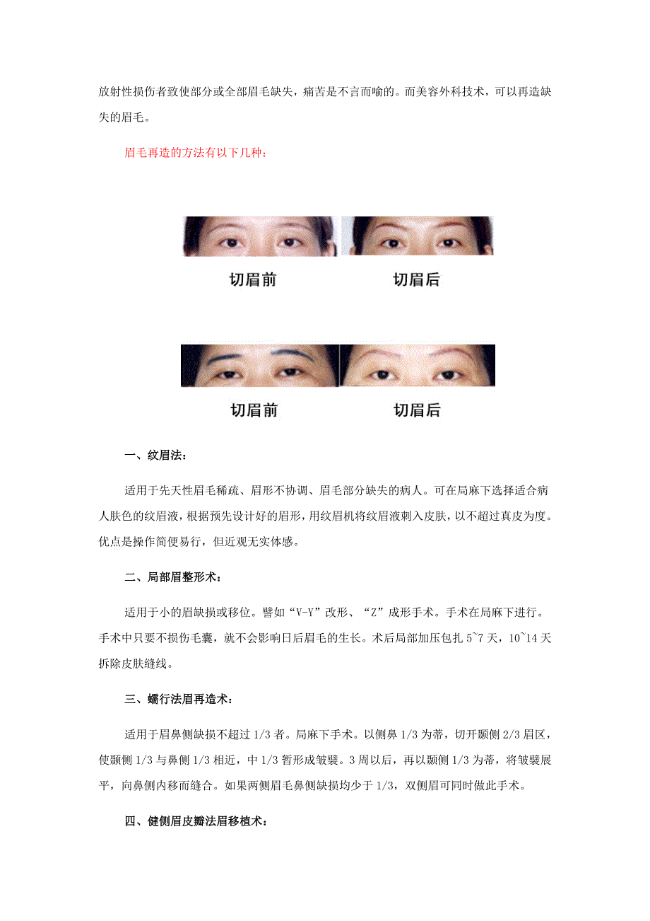 美基元专家讲解眉的意义与再造眉法.doc_第4页