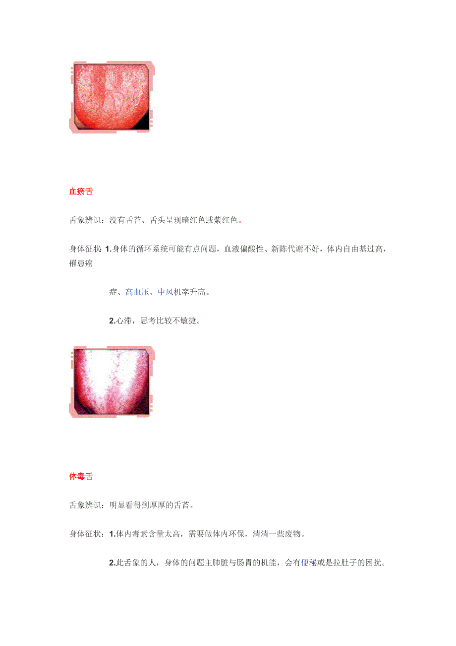 中医舌诊的常见病图谱(转载) (2).doc_第3页