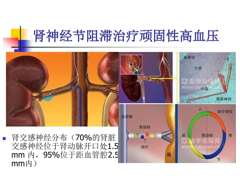 不常用的心脏介入治疗ppt课件_第4页