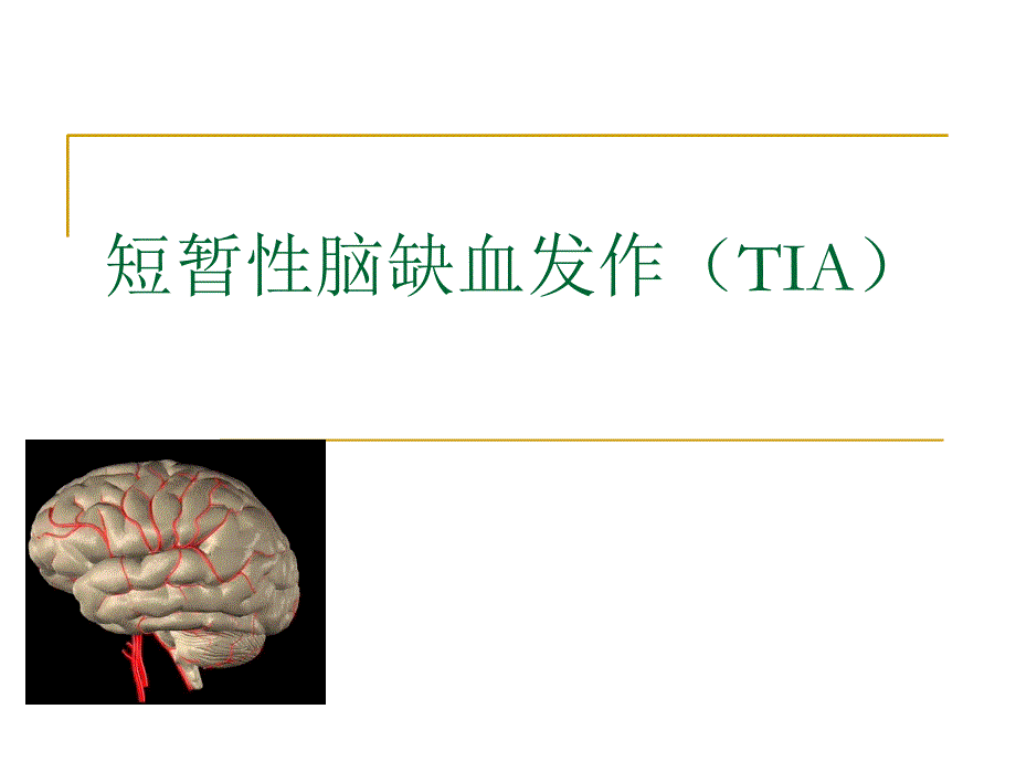 TIA短暂性脑缺血发作_第1页