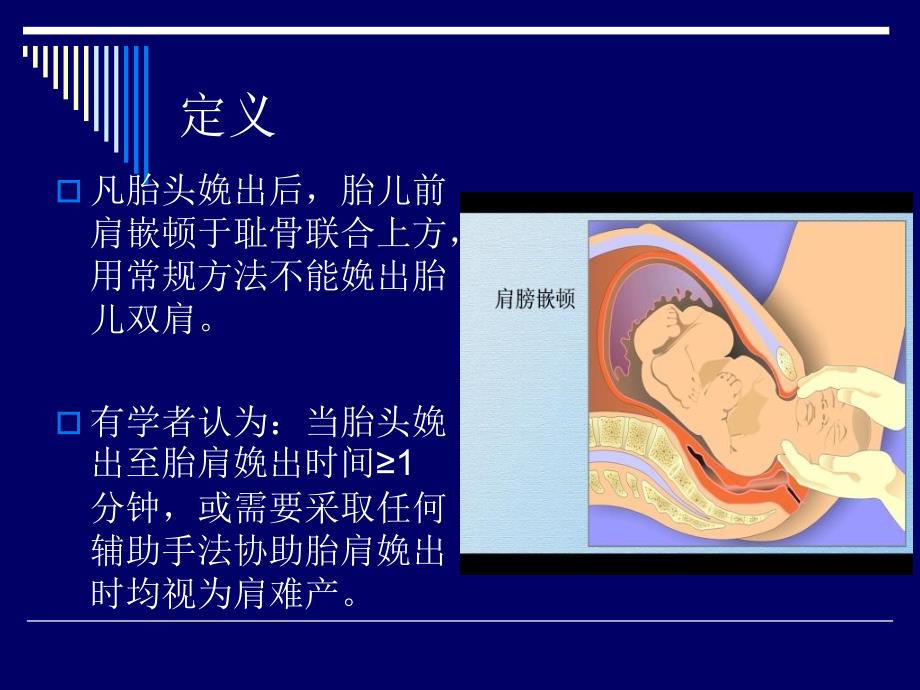 肩难产的紧急处理_第3页