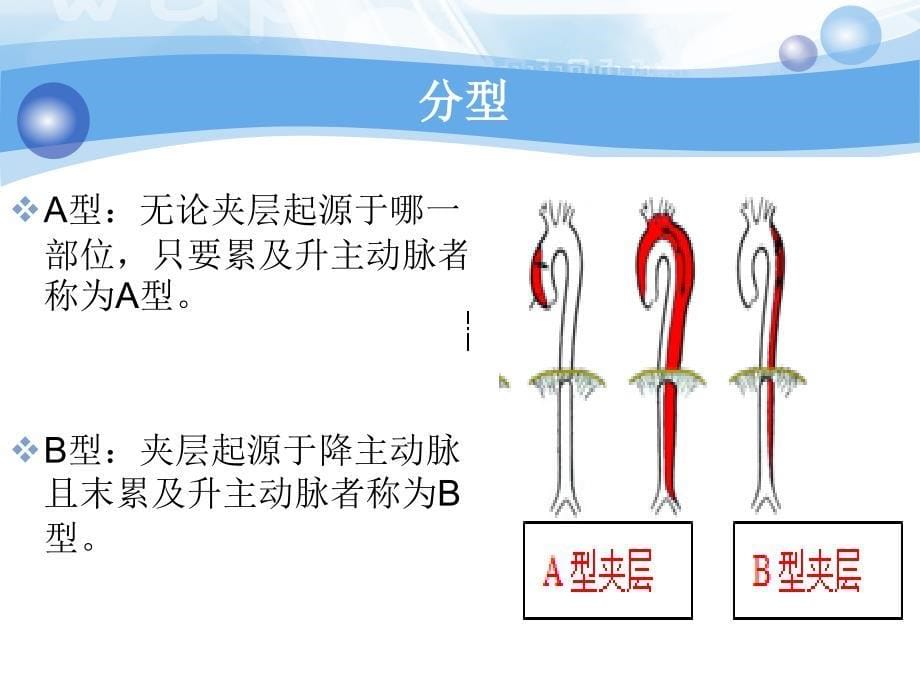 医学专题：主动脉夹层的急救处理_第5页