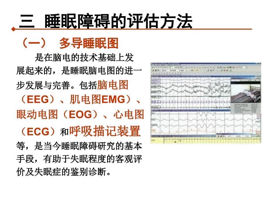 [整理版]睡眠障碍康复治疗课件_第5页