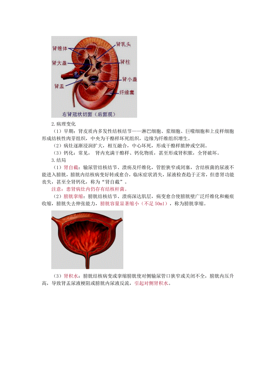 第五章 肾结核 (2).doc_第2页