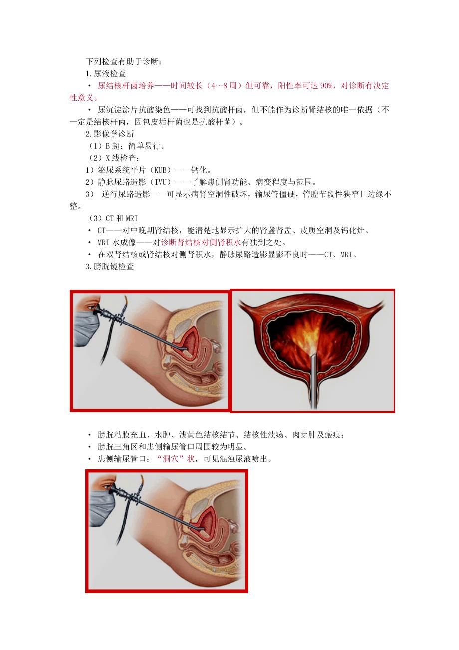 第五章 肾结核 (2).doc_第4页