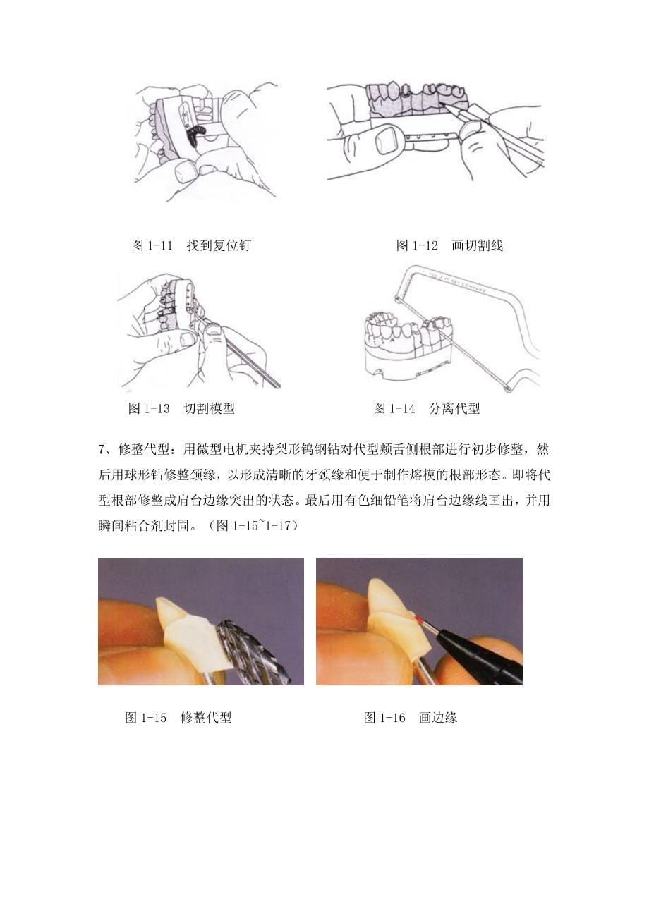 固定义齿工艺技术项目一-代型制作.doc_第5页