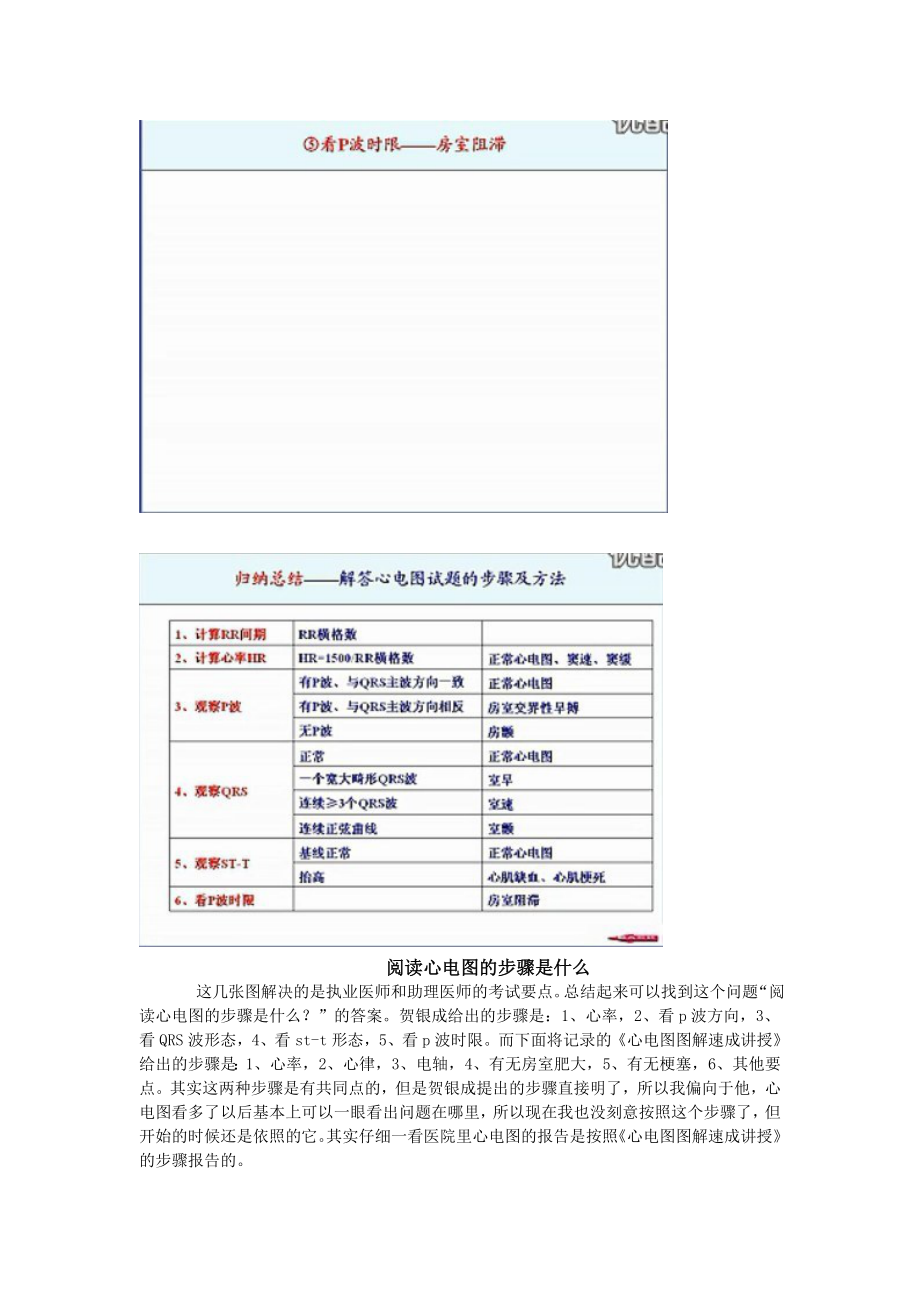 【推荐下载】心电图总结.doc_第4页